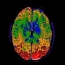 Color Mapping Brain MRI